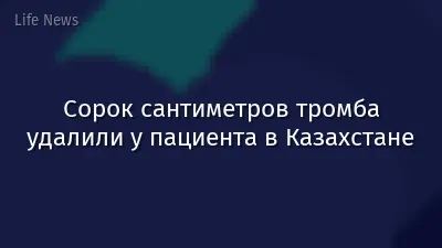 Сорок сантиметров тромба удалили у пациента в Казахстане